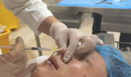 扎针视频,视频教学带你轻松掌握