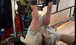 疝气手术视频,从术前准备到术后恢复